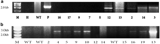 Trisomy 11 in myelodysplastic syndromes defines a unique group of disease with aggressive clinicopathologic features