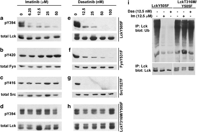 Lck Is A Key Target Of Imatinib And Dasatinib In T Cell Activation Leukemia