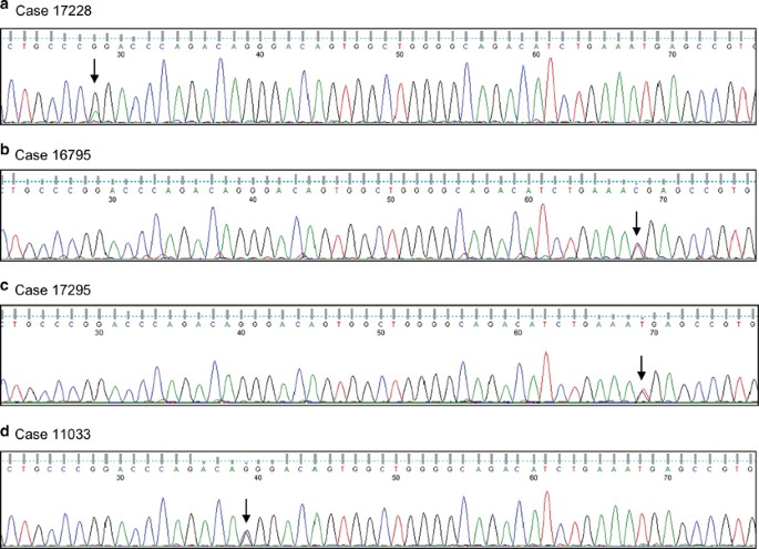Colony-stimulating factor-3 receptor, watch out for polymorphisms