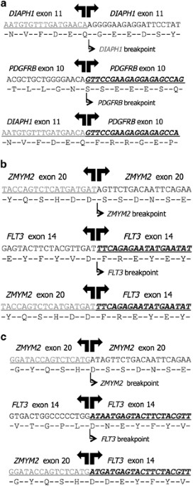 Cytogenetically Cryptic Zmym2 Flt3 And Diaph1 Pdgfrb Gene Fusions In Myeloid Neoplasms With Eosinophilia Leukemia