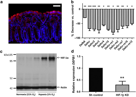 Fundamental role for hif-1α in constitutive expression of human β defensin-1