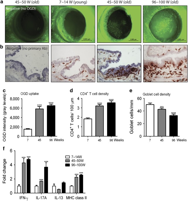 Age Related Spontaneous Lacrimal Keratoconjunctivitis Is Accompanied By Dysfunctional T Regulatory Cells Mucosal Immunology