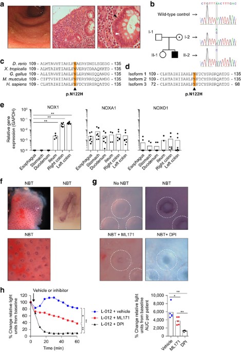 Nox1 Loss Of Function Genetic Variants In Patients With
