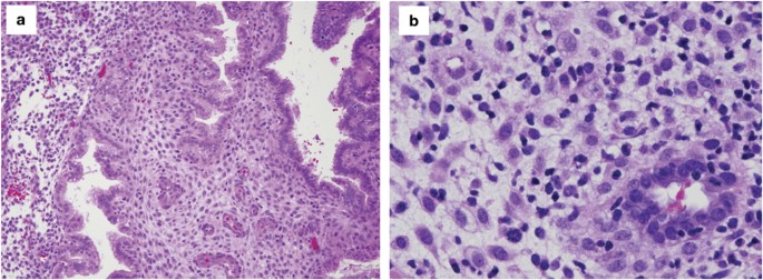 Endometrium histology proliferative Pathology Outlines