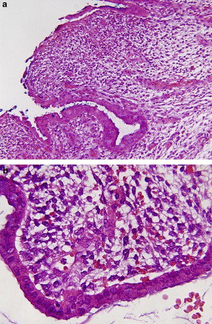 Louis P. Dehner, MD, Pathology & Immunology