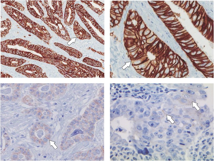 vaccin hpv 9 tulpini pret