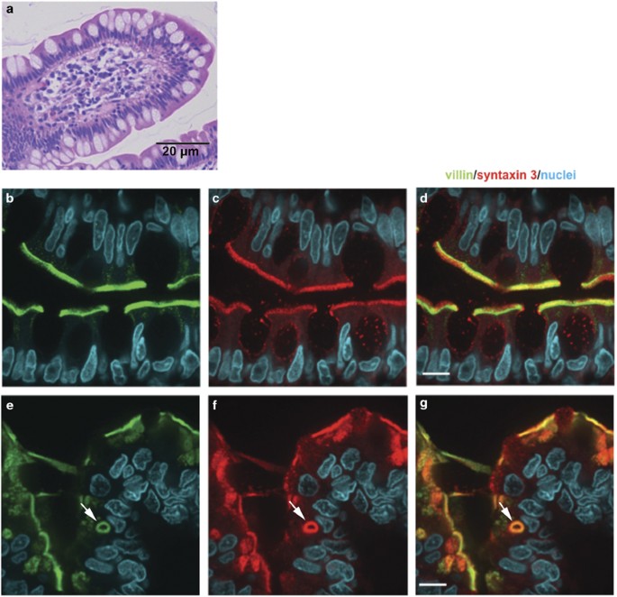 Multilabel Immunofluorescence And Antigen Reprobing On Formalin Fixed Paraffin Embedded Sections Novel Applications For Precision Pathology Diagnosis Modern Pathology