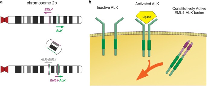 Genomic Heterogeneity Of Alk Fusion Breakpoints In Non Small Cell Lung Cancer Modern Pathology