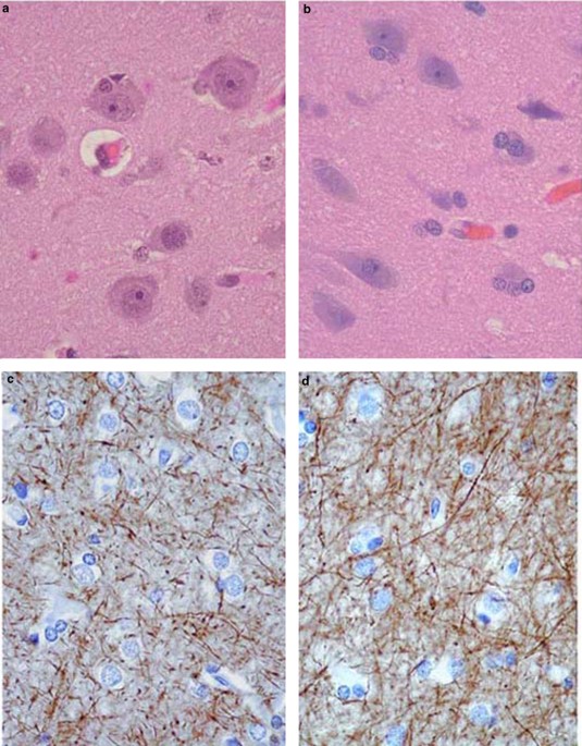 Ultrasoundaccelerated formalin fixation of tissue improves morphology