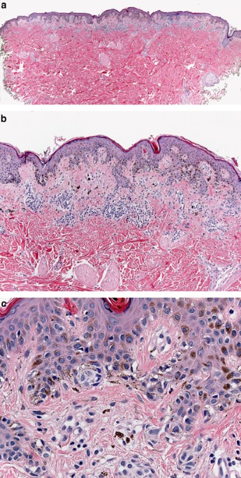 Solved The Dermis Extends Upward Between Ridges of