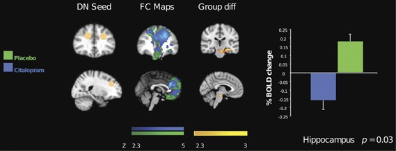 Ssri Administration Reduces Resting State Functional Connectivity In Dorso Medial Prefrontal Cortex Molecular Psychiatry Ssri Administration Reduces Resting State Functional Connectivity In Dorso Medial Prefrontal Cortex Molecular Psychiatry