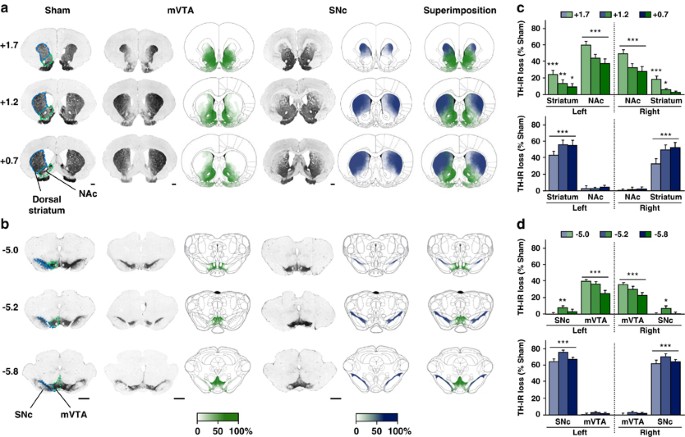 Loss of dopaminergic nigrostriatal neurons accounts for the motivational and affective deficits in parkinson’s disease