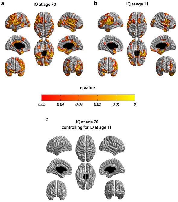 Childhood Cognitive Ability Accounts For Associations Between Cognitive Ability And Brain Cortical Thickness In Old Age Molecular Psychiatry