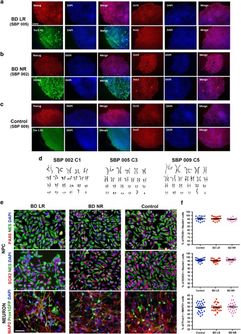 Neurons derived from patients with bipolar disorder divide into intrinsically different sub-populations of neurons, predicting the patients’ responsiv
