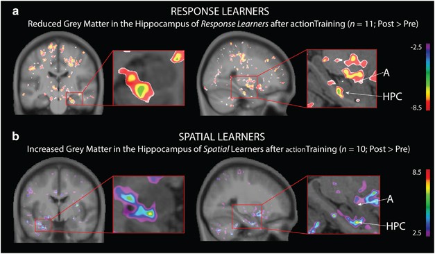 Impact of video games on plasticity of the hippocampus