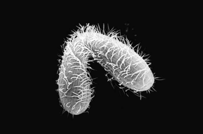 Bugün öğrendim ki: Tek hücreli kirpikli tek...