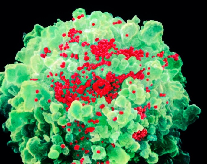 Hiv vaccine raised infection risk