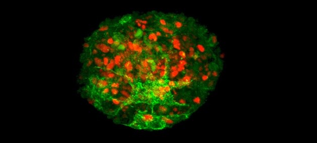 Cultured follicles offer hope for beating baldness