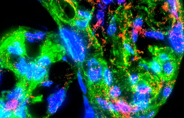 Nih invests us$41. 5 million in placenta research