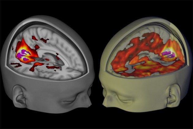 http://www.nature.com/news/brain-scans-reveal-how-lsd-affects-consciousness-1.19727 social preview image