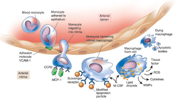 Inflammation atherosclerosis | Nature