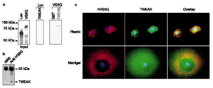 (PDF) Identification of de novo EP300 and PLAU variants in a patient with  Rubinstein–Taybi syndrome-related arterial vasculopathy and skeletal anomaly