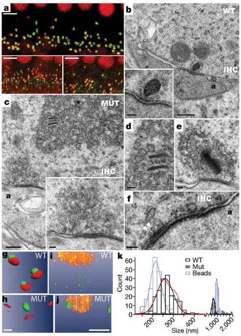 Zinc deficiency triggers hearing loss by reducing ribbon synapses of inner  hair cells in CBA/N mice - ScienceDirect