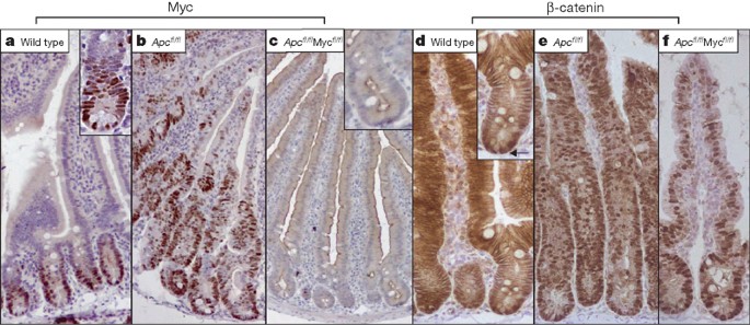 Myc deletion rescues Apc deficiency in the small intestine | Nature