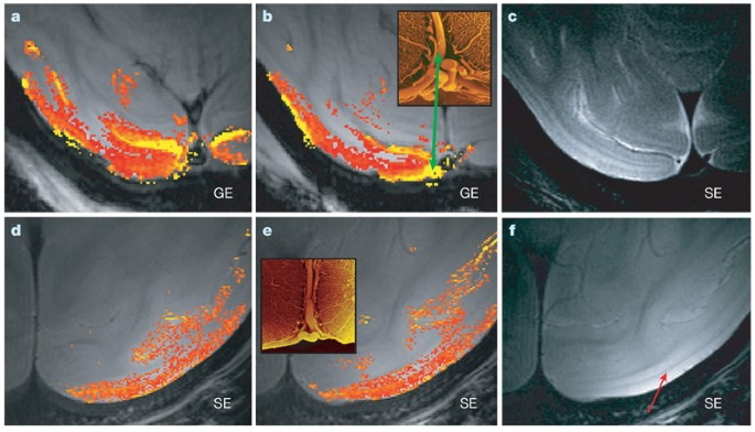 What We Can Do And What We Cannot Do With Fmri Nature - 