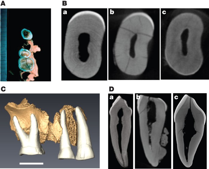 The Earliest Evidence For Anatomically Modern Humans In Northwestern Europe Nature