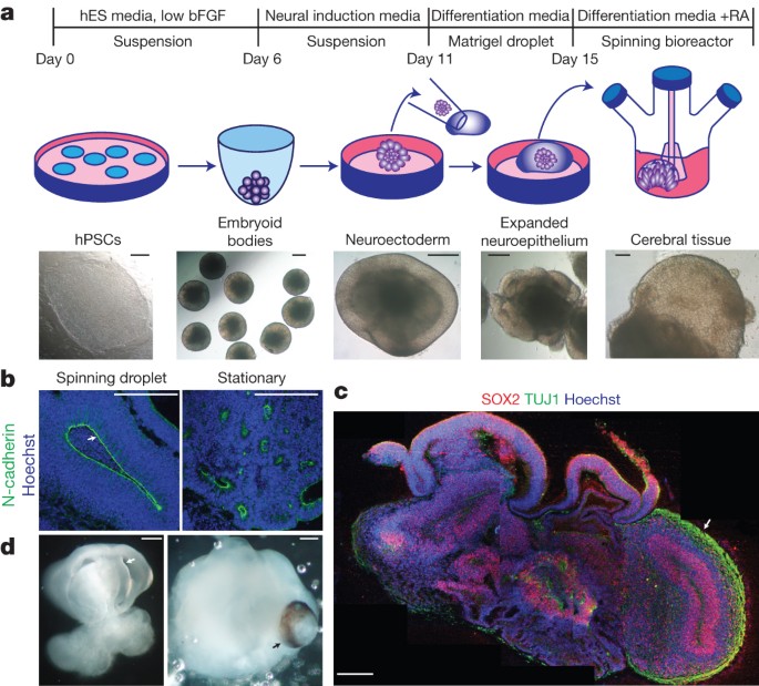 Picture of Cerebral organoid