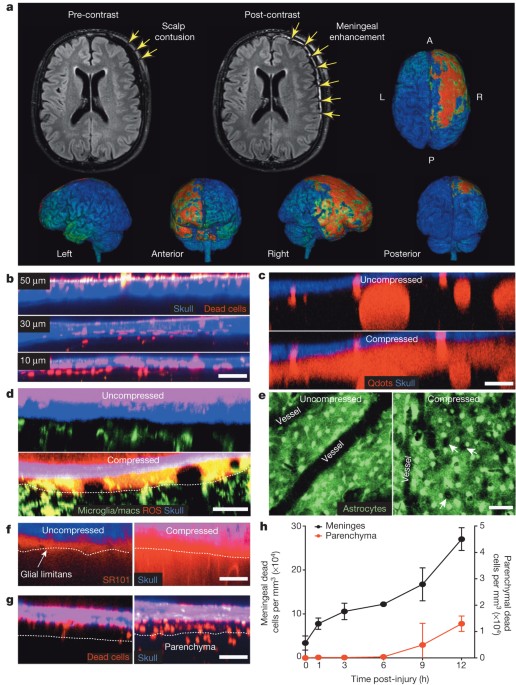 Transcranial amelioration of inflammation and cell death after brain injury 