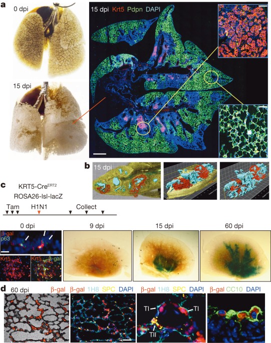 P63+krt5+ distal airway stem cells are essential for lung regeneration