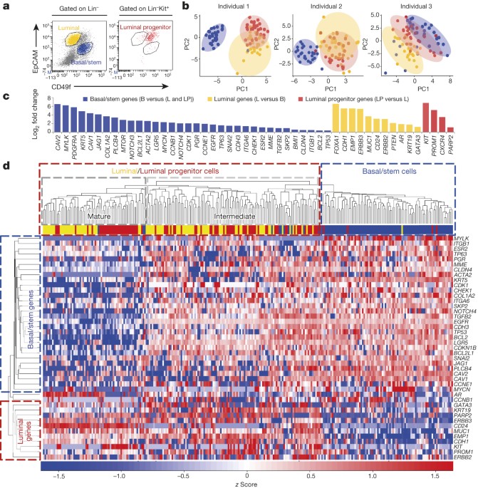 Single-cell analysis reveals a stem-cell program in human metastatic breast  cancer cells
