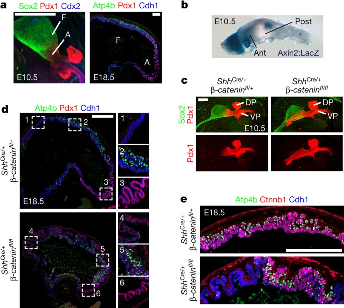 Wnt B Catenin Promotes Gastric Fundus Specification In Mice And Humans Nature