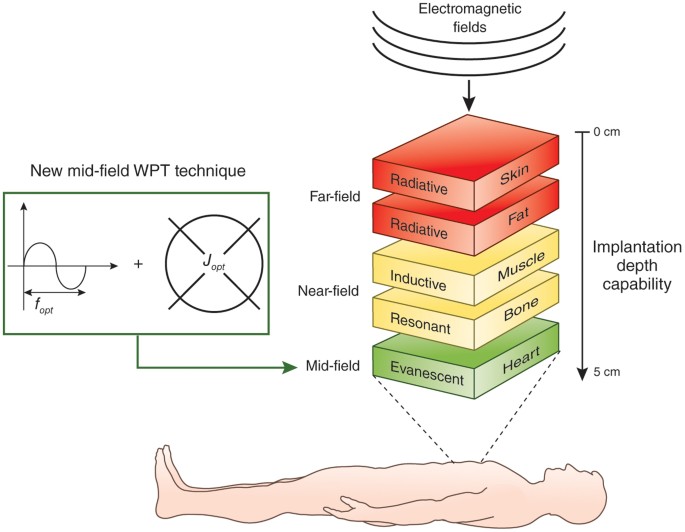 Miniaturizing wireless implants