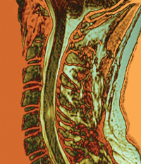 feature-image