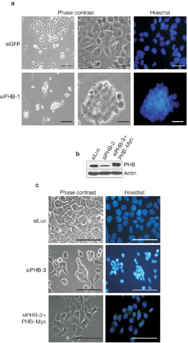 Prohibitin is required for ras-induced raf–mek–erk activation and epithelial cell migration