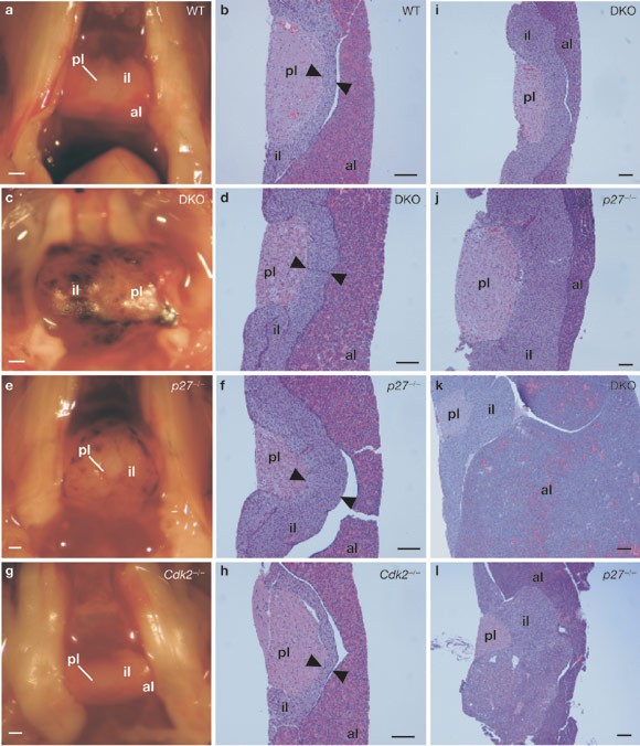 Cdc2–cyclin e complexes regulate the g1/s phase transition
