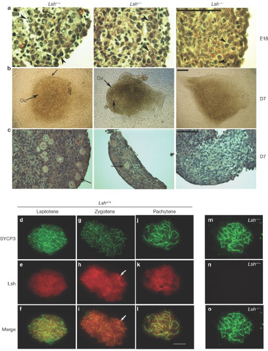 Lsh is required for meiotic chromosome synapsis and 