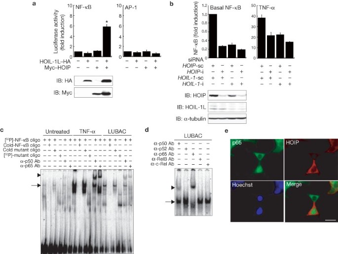 kb glutathione before and after Involvement of linear polyubiquitylation of NEMO in NF-κB activation