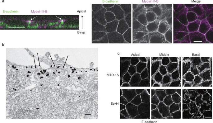 Α-catenin as a tension transducer that induces adherens junction development