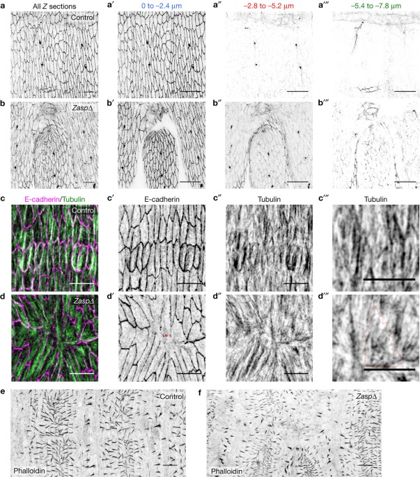 The actin cable is dispensable in directing dorsal closure dynamics but  neutralizes mechanical stress to prevent scarring in the Drosophila embryo  | Nature Cell Biology