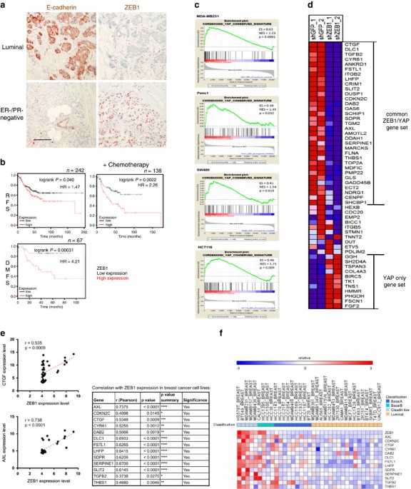 Zeb1 Turns Into A Transcriptional Activator By Interacting With Yap1 In Aggressive Cancer Types Nature Communications
