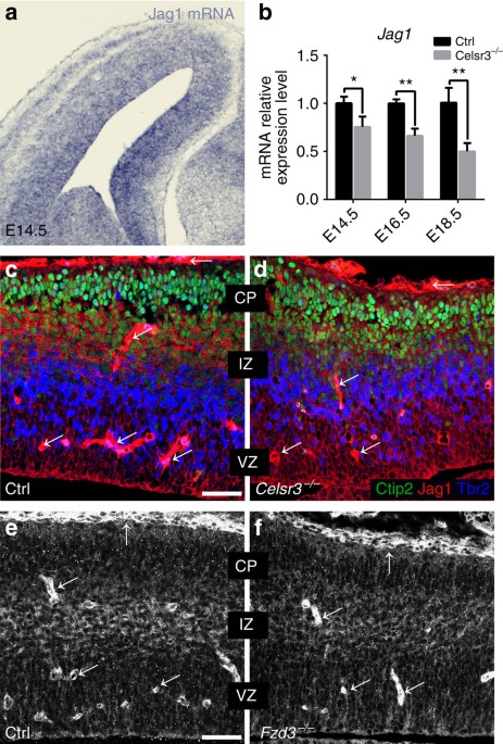 Celsr3 is required in motor neurons to steer their axons in the