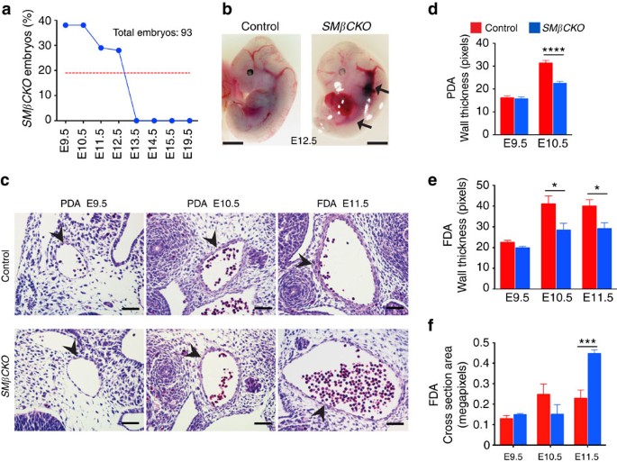 B Catenin C Terminal Signals Suppress P53 And Are Essential For Artery Formation Nature Communications