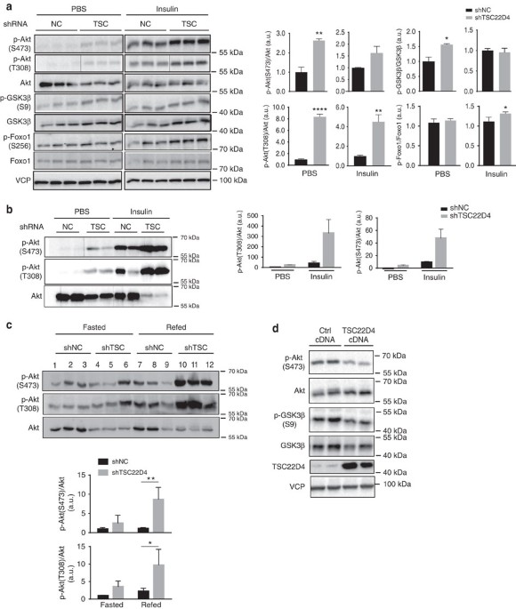 Control of diabetic hyperglycaemia and insulin resistance through tsc22d4