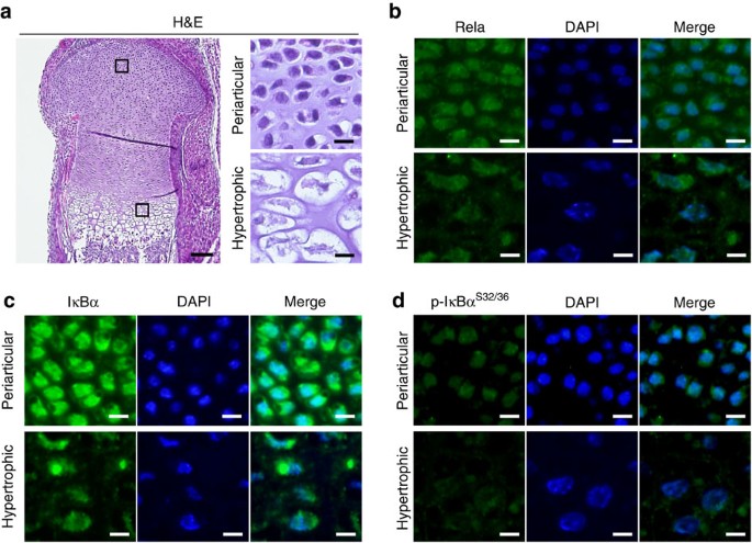 Biphasic Regulation Of Chondrocytes By Rela Through Induction Of Anti Apoptotic And Catabolic Target Genes Nature Communications
