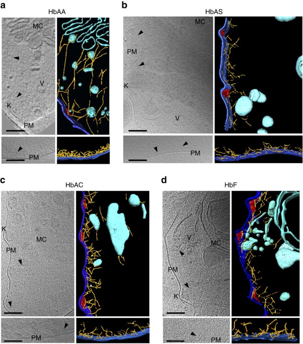 Oxidative Insult Can Induce Malaria Protective Trait Of Sickle And Fetal Erythrocytes Nature Communications