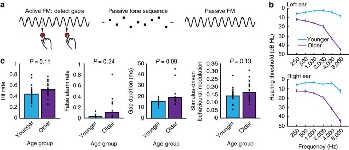 Aging affects the balance of neural entrainment and top-down neural  modulation in the listening brain | Nature Communications